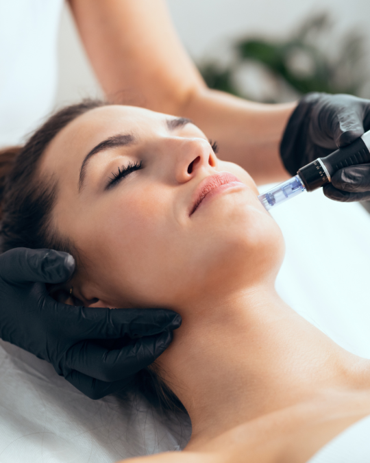 Swanbeautystudio.nl - Micro-needling